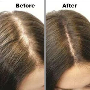 ¿Los cascos de luz roja funcionan para el crecimiento del cabello?
